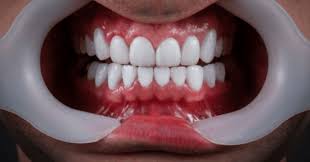 Cosmetic dentistry beautiful smile